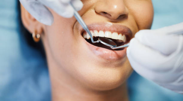Best Emergency Root Canal Treatment in Benld, IL