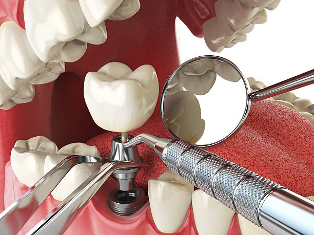 Best Emergency Dental Surgery in Benld, IL