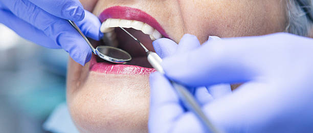 Best Emergency Tooth Extraction in Benld, IL