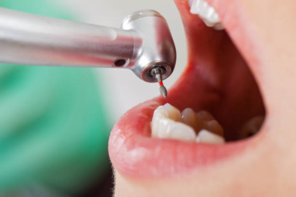 Best Emergency Broken Tooth Repair in Benld, IL